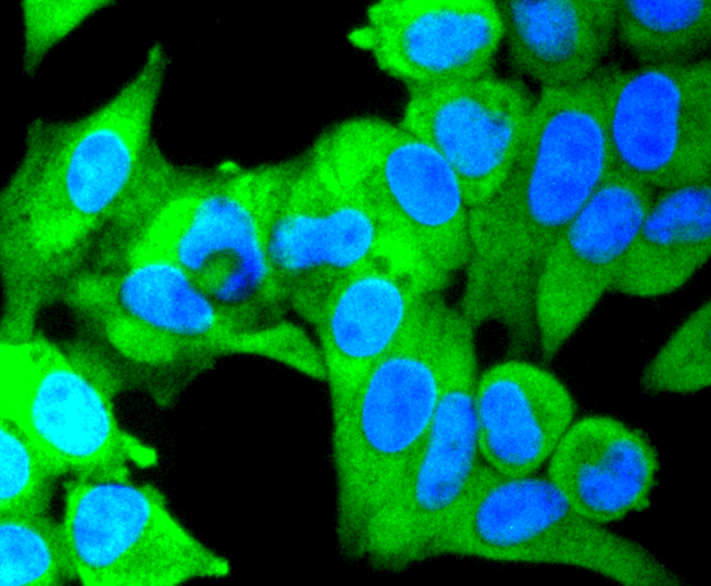 IKK alpha + IKK beta Rabbit mAb