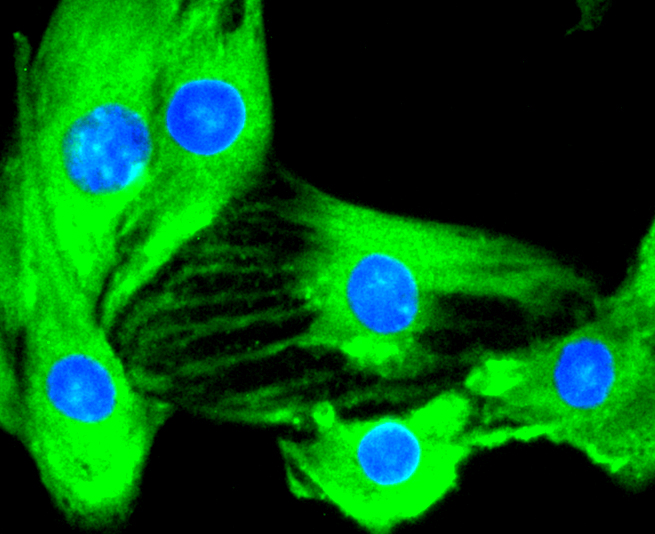 IKK alpha + IKK beta Rabbit mAb