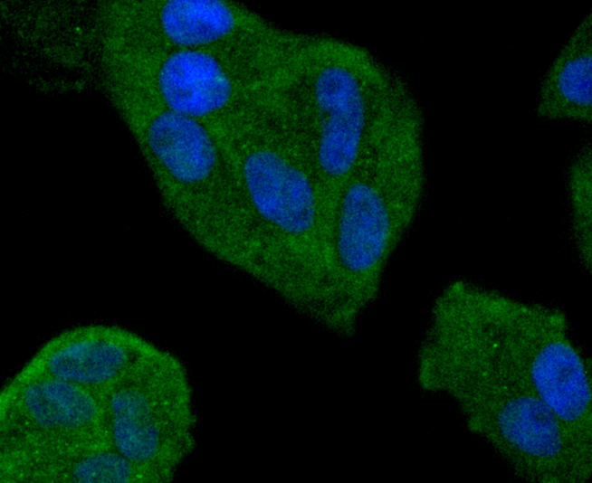 Smad4 Rabbit mAb