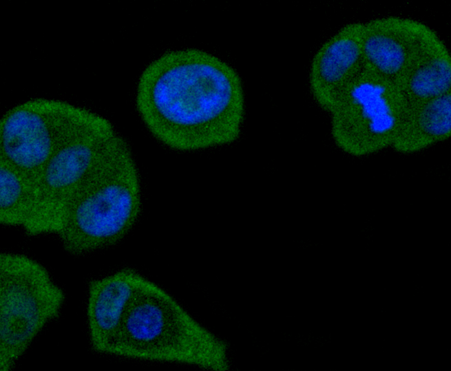 Smad4 Rabbit mAb