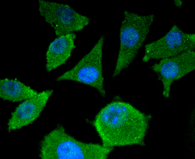 Smad4 Rabbit mAb