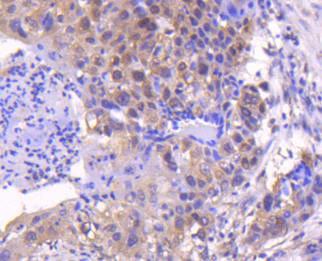 Smad4 Rabbit mAb