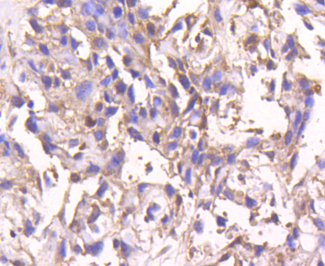 Smad4 Rabbit mAb