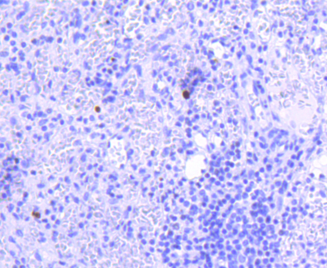 Phospho-JAK2(Y1007+Y1008) Rabbit mAb