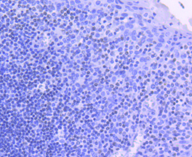 Phospho-JAK2(Y1007+Y1008) Rabbit mAb