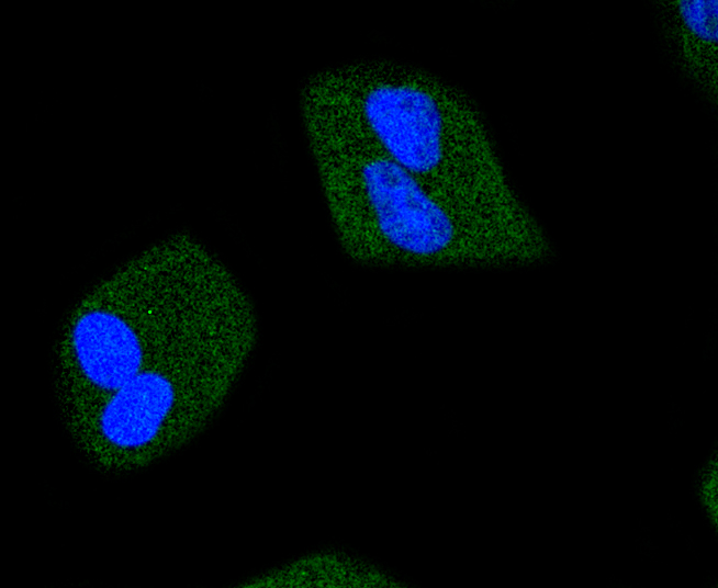 Phospho-JAK2(Y1007+Y1008) Rabbit mAb