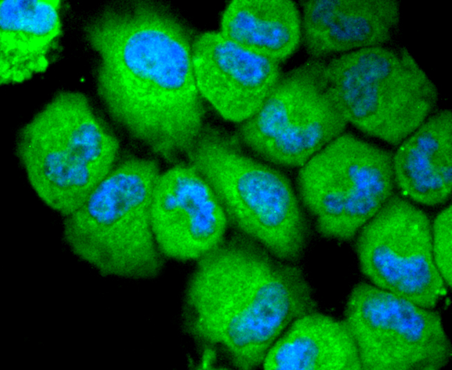 NLRP3 Rabbit mAb