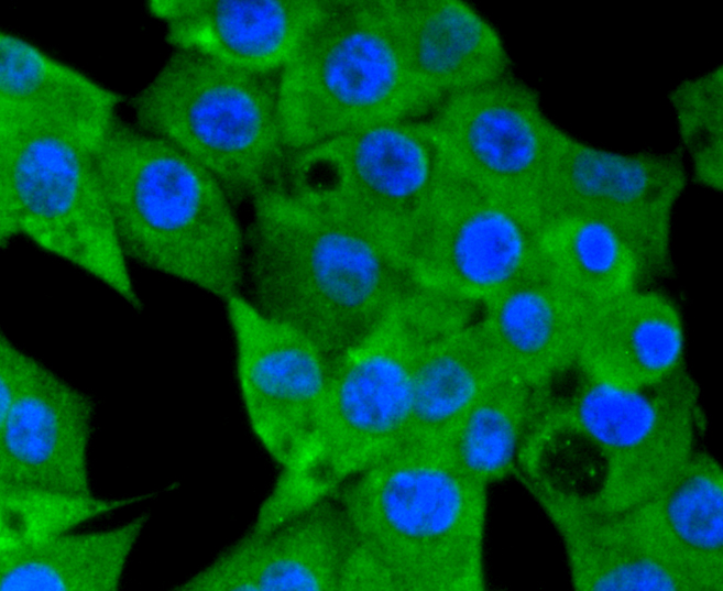 NLRP3 Rabbit mAb