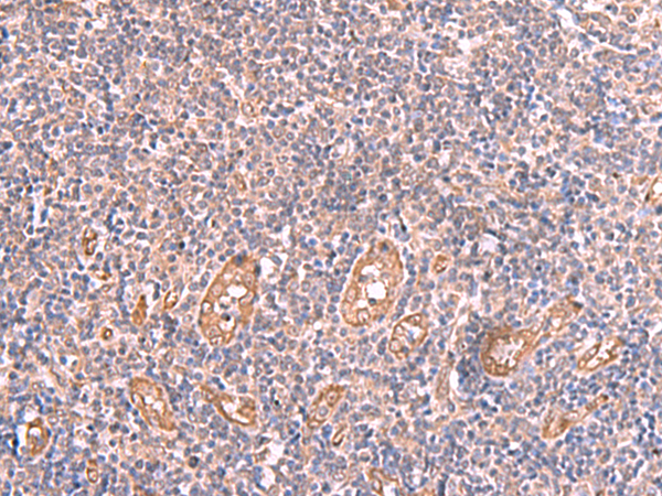 LMCD1 Antibody