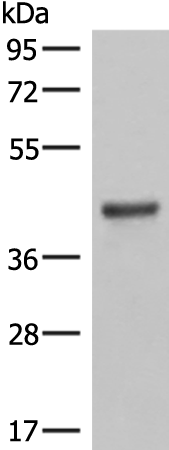 LMCD1 Antibody