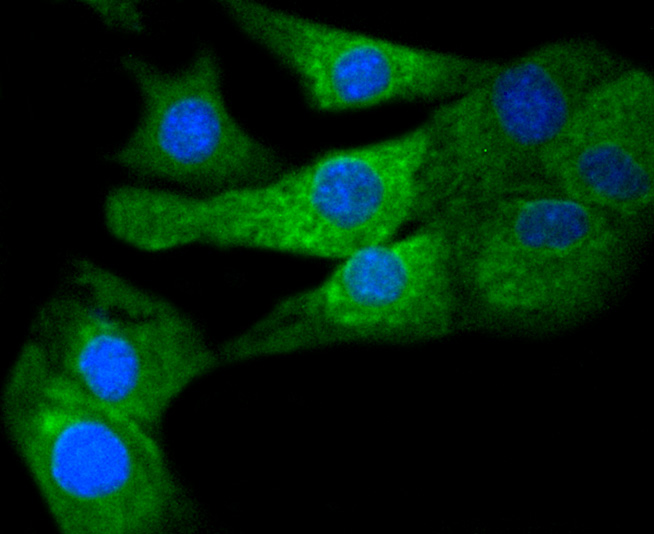 COX1/Cyclooxygenase 1 Rabbit mAb