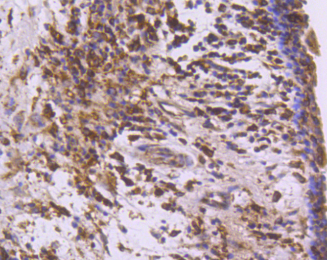 COX1/Cyclooxygenase 1 Rabbit mAb