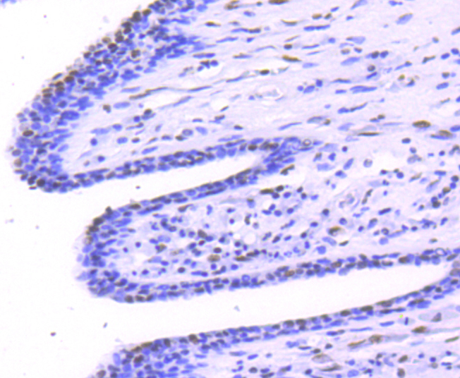 Phospho-STAT1(S727) Rabbit mAb