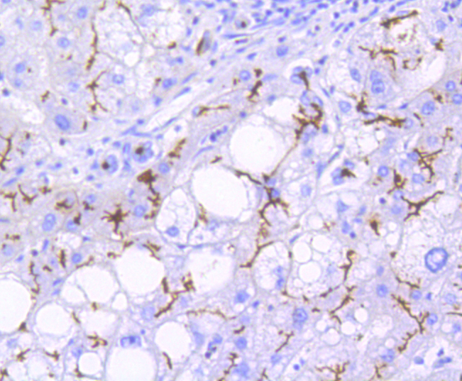 P Glycoprotein Rabbit mAb