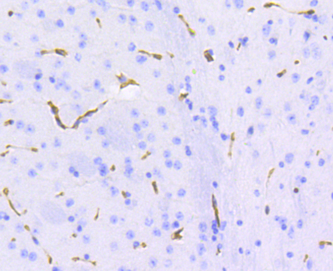 P Glycoprotein Rabbit mAb