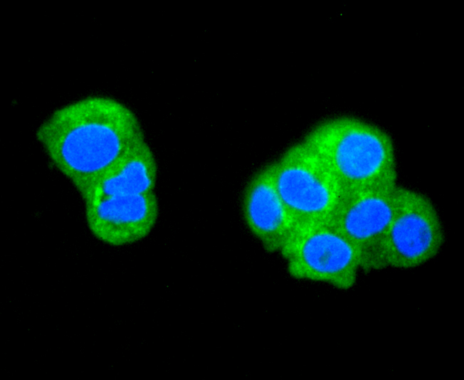 ATG5 Rabbit mAb