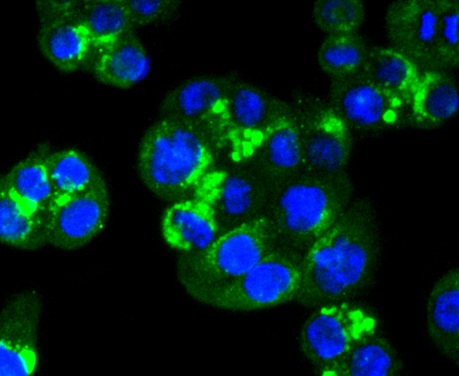 RAB7 Rabbit mAb