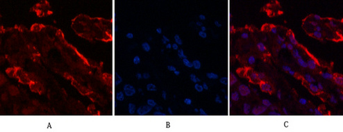 Galectin-3 Mouse Monoclonal Antibody