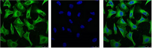 EGFR Mouse Monoclonal Antibody