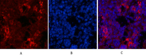 ErbB-2/HER-2 Mouse Monoclonal Antibody