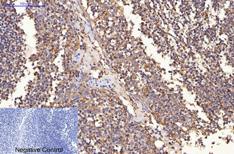 ErbB-2/HER-2 Mouse Monoclonal Antibody