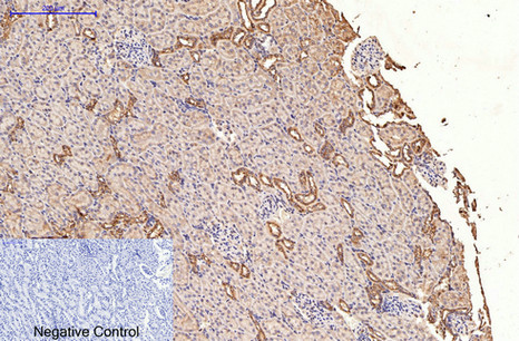 ErbB-2/HER-2 Mouse Monoclonal Antibody