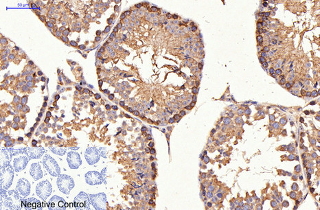 ErbB-2/HER-2 Mouse Monoclonal Antibody