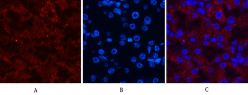 AMACR/P504S Mouse Monoclonal Antibody