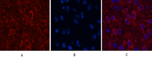 AMACR/P504S Mouse Monoclonal Antibody