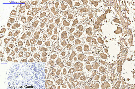 AMACR/P504S Mouse Monoclonal Antibody