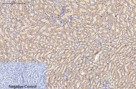 AMACR/P504S Mouse Monoclonal Antibody