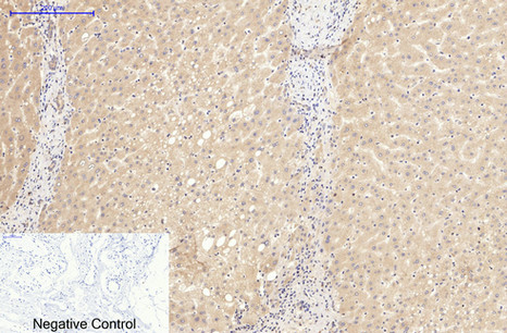 CD20 Mouse Monoclonal Antibody