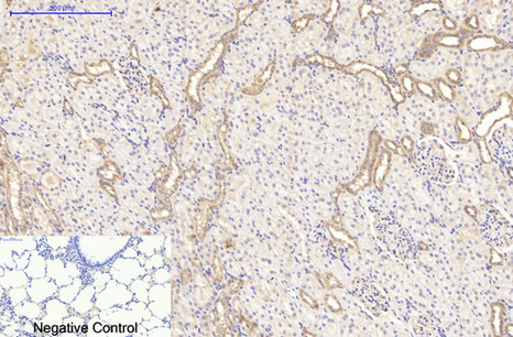 CD20 Mouse Monoclonal Antibody