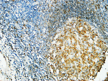 CD20 Mouse Monoclonal Antibody