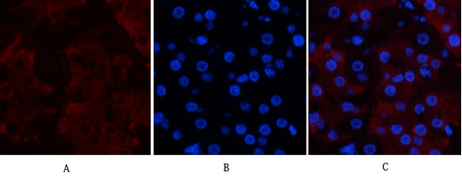 CD23 Mouse Monoclonal Antibody