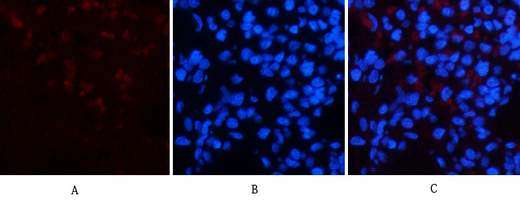 CD23 Mouse Monoclonal Antibody