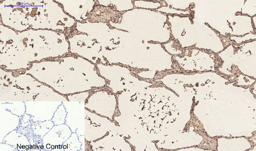 CD23 Mouse Monoclonal Antibody