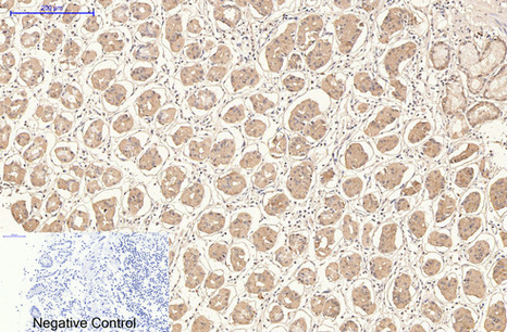 CD21 Mouse Monoclonal Antibody