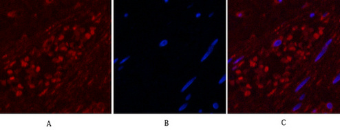 NSE Mouse Monoclonal Antibody