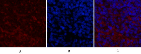 NSE Mouse Monoclonal Antibody