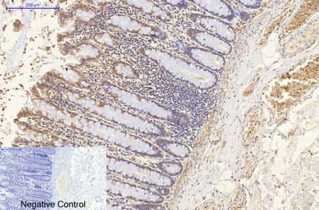 NSE Mouse Monoclonal Antibody