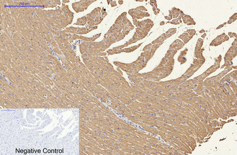 NSE Mouse Monoclonal Antibody