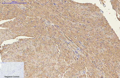 NSE Mouse Monoclonal Antibody