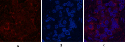 Fumarase Mouse Monoclonal Antibody(7F1)