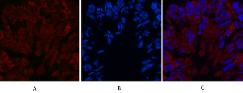 Fumarase Mouse Monoclonal Antibody(7F1)