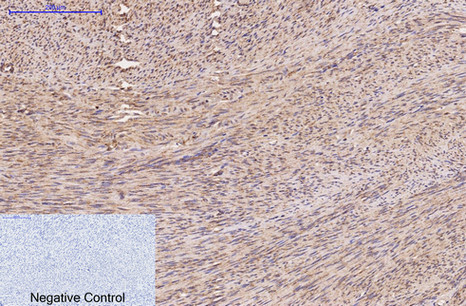 Fumarase Mouse Monoclonal Antibody(7F1)