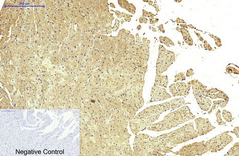 Fumarase Mouse Monoclonal Antibody(7F1)