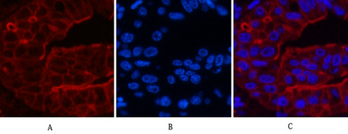 ABCB5 Mouse Monoclonal Antibody