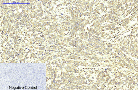 ABCB5 Mouse Monoclonal Antibody