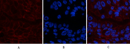 Carbonic Anhydrase IX Mouse Monoclonal Antibody